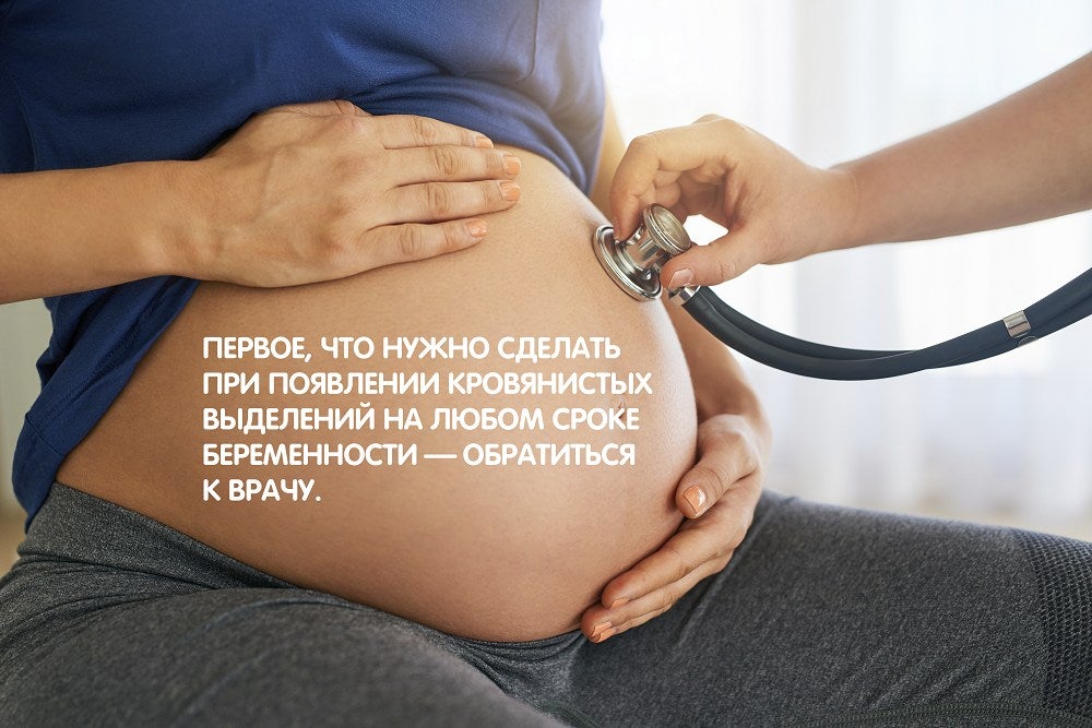 Что делать, если началось кровотечение во время беременности?