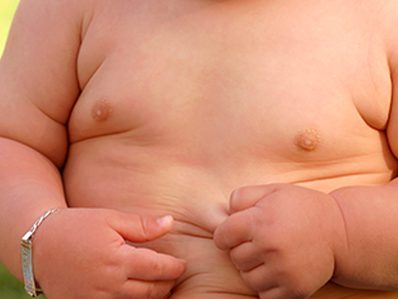 Зайва вага у дитини: причини, небезпека та як боротися з дитячим ожирінням