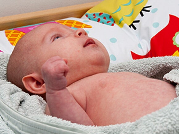 Діатез у немовляти: що це і як допомогти дитині?