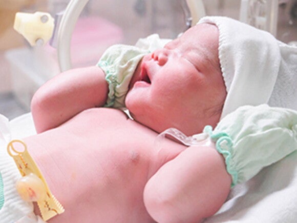 Асфіксія у новонароджених: симптоми і наслідки