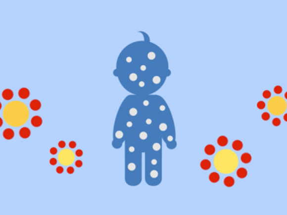 Правильний білок у харчуванні малюка – профілактика виникнення алергії